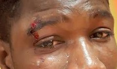 Vicini al ragazzo senegalese aggredito dai razzisti ed appello per far crescere solidarieta' 21 ragazzopicchiato3-kLlE-U31602142021108XMI-526x284Corriere-Web-Sezioni